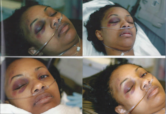 Salisa Luster in Hospital